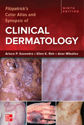 Image of Fitzpatrick's Color Atlas and Synopsis of Clinical Dermatology Ninth Edition
